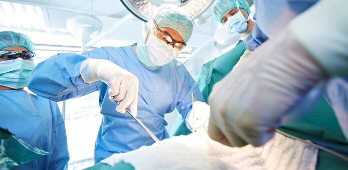 Surgery to increase a member